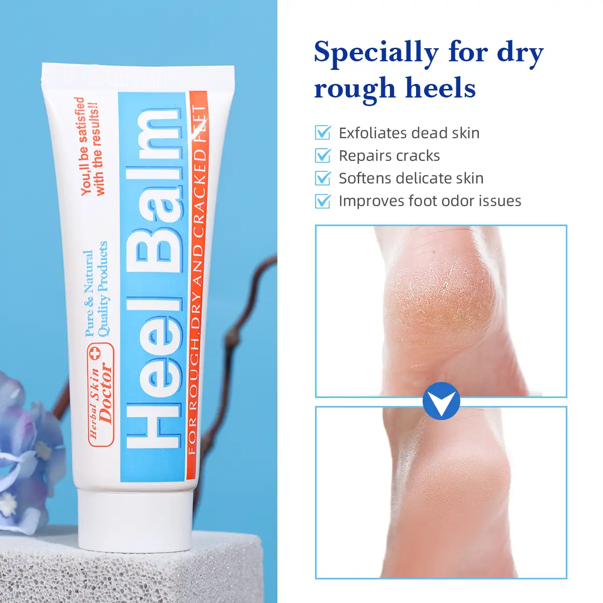 Moisturizing Heel Balm for Dry, Rough & Cracked Heels - Image 2